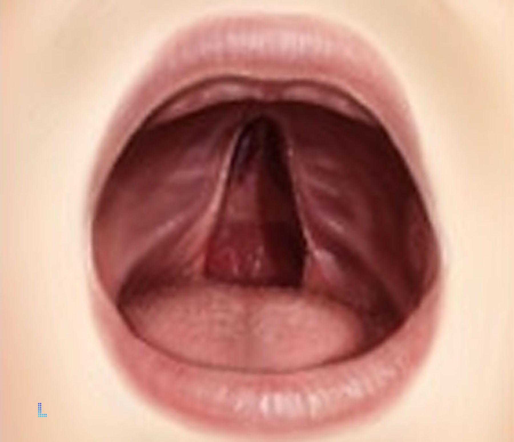 Best Cleft Palate Lahore