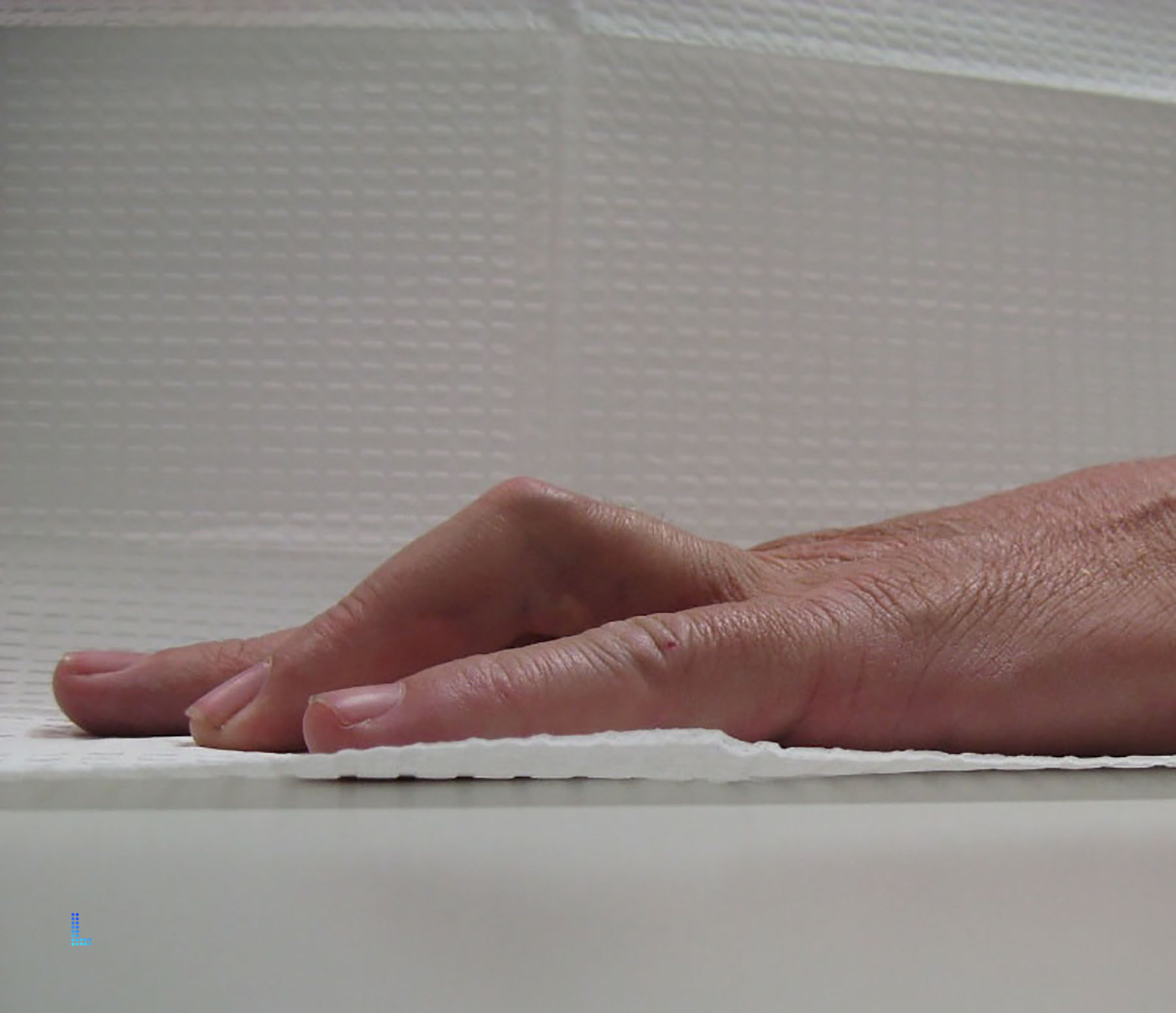 contracture treatment in Lahore