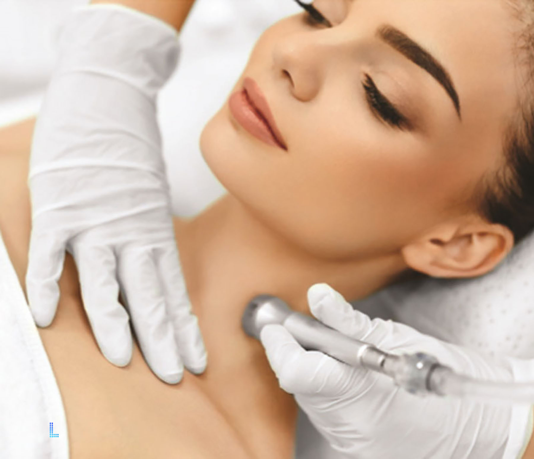 Best Dermabrasion acne in Lahore
