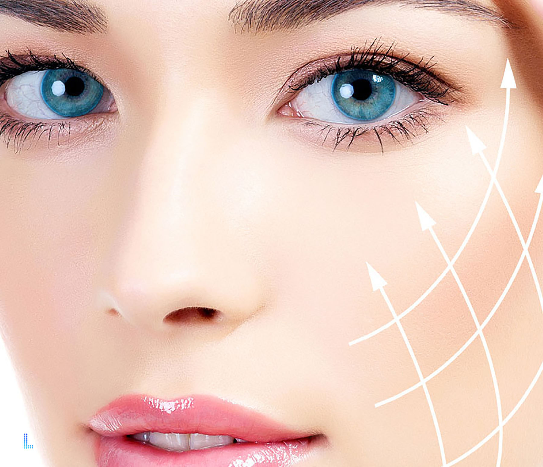 Ideal Face Lift Patients Lahore