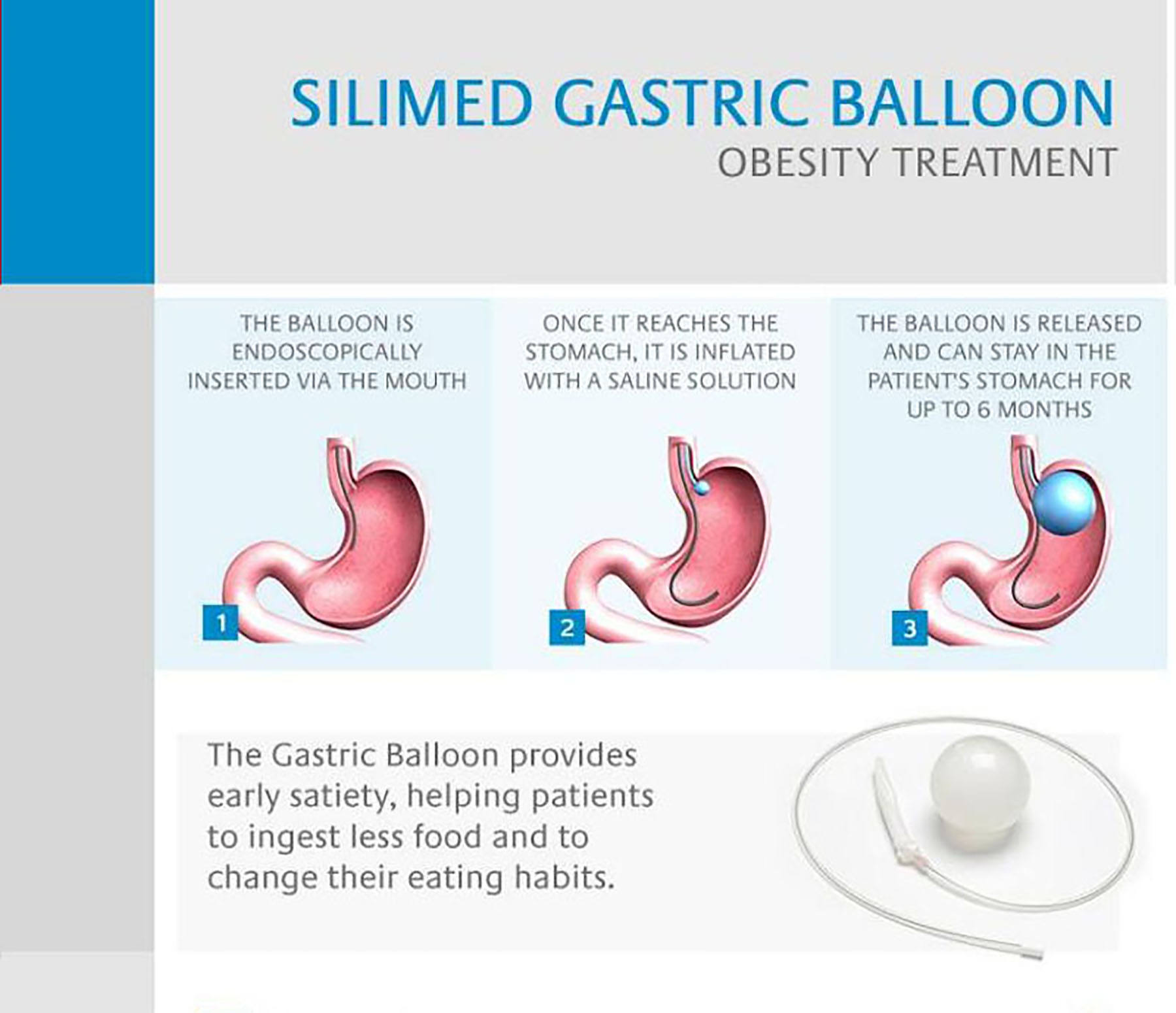 Anesthesia for Plastic Surgery in Lahore