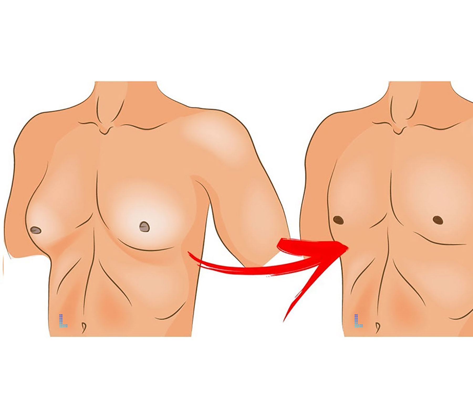 Follow Ups of Plastic Surgery