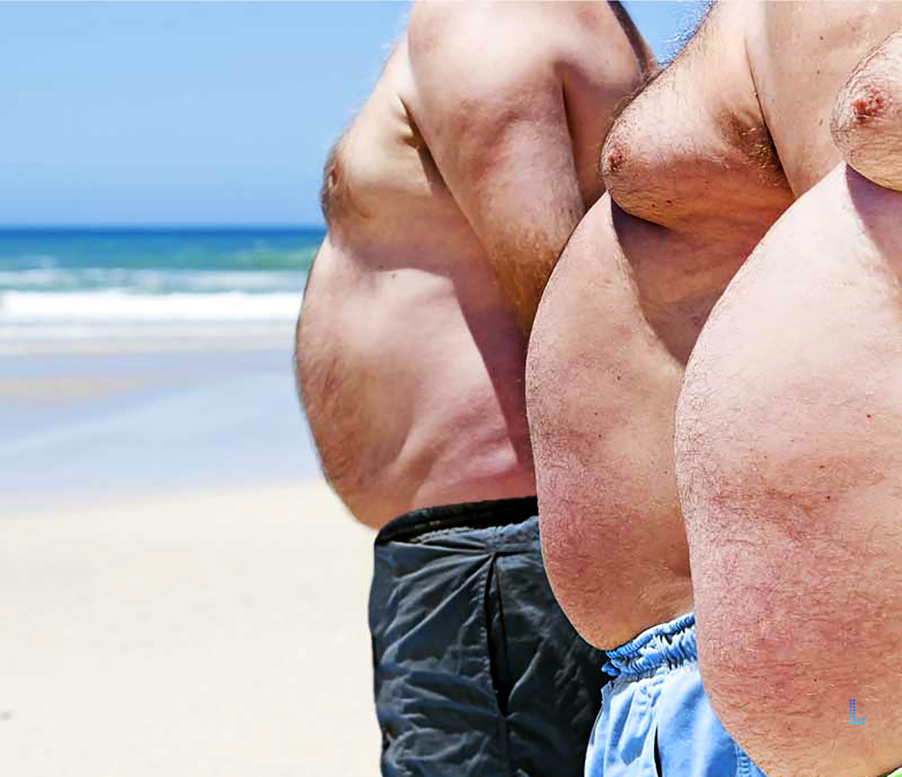 Best Cosmetic Male Breasts Removal in Lahore