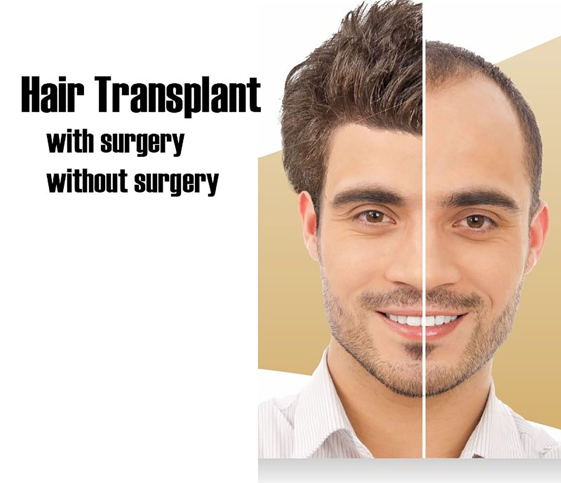 Detail of  Hair transplant Procedure in Lahore