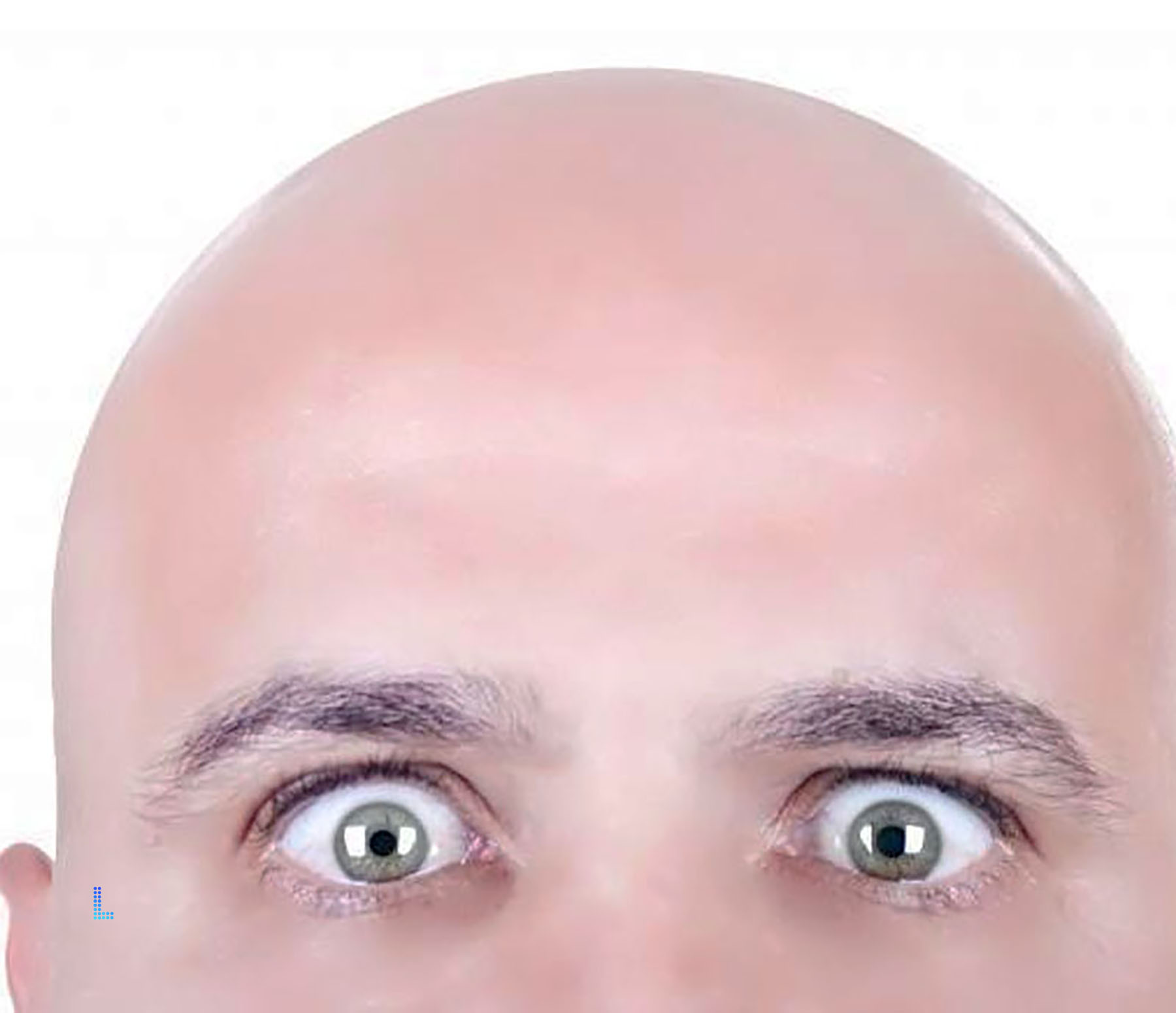 Best Hair Growth Therapy in Lahore
