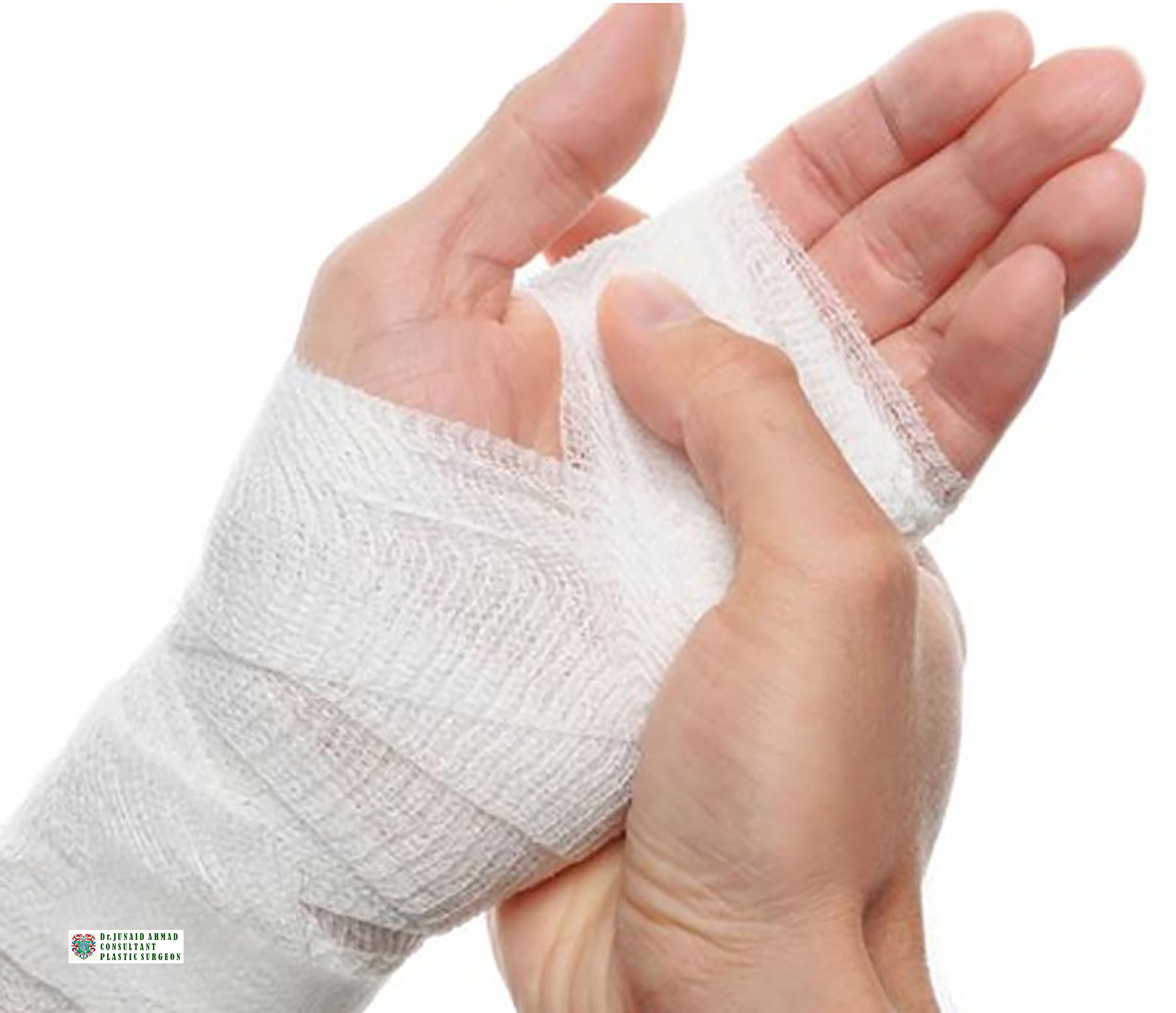 Follow Ups of hand Plastic Surgery
