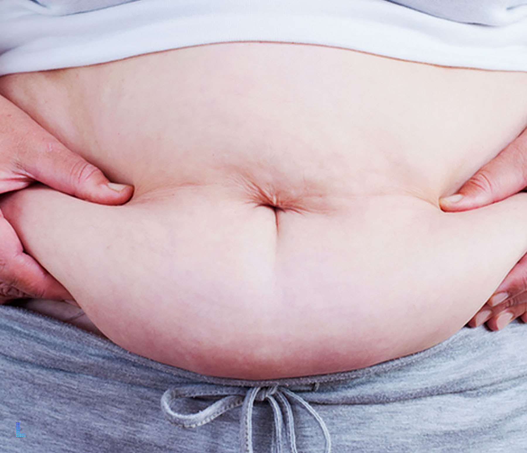 Common Hernia Procedures to do in Lahore