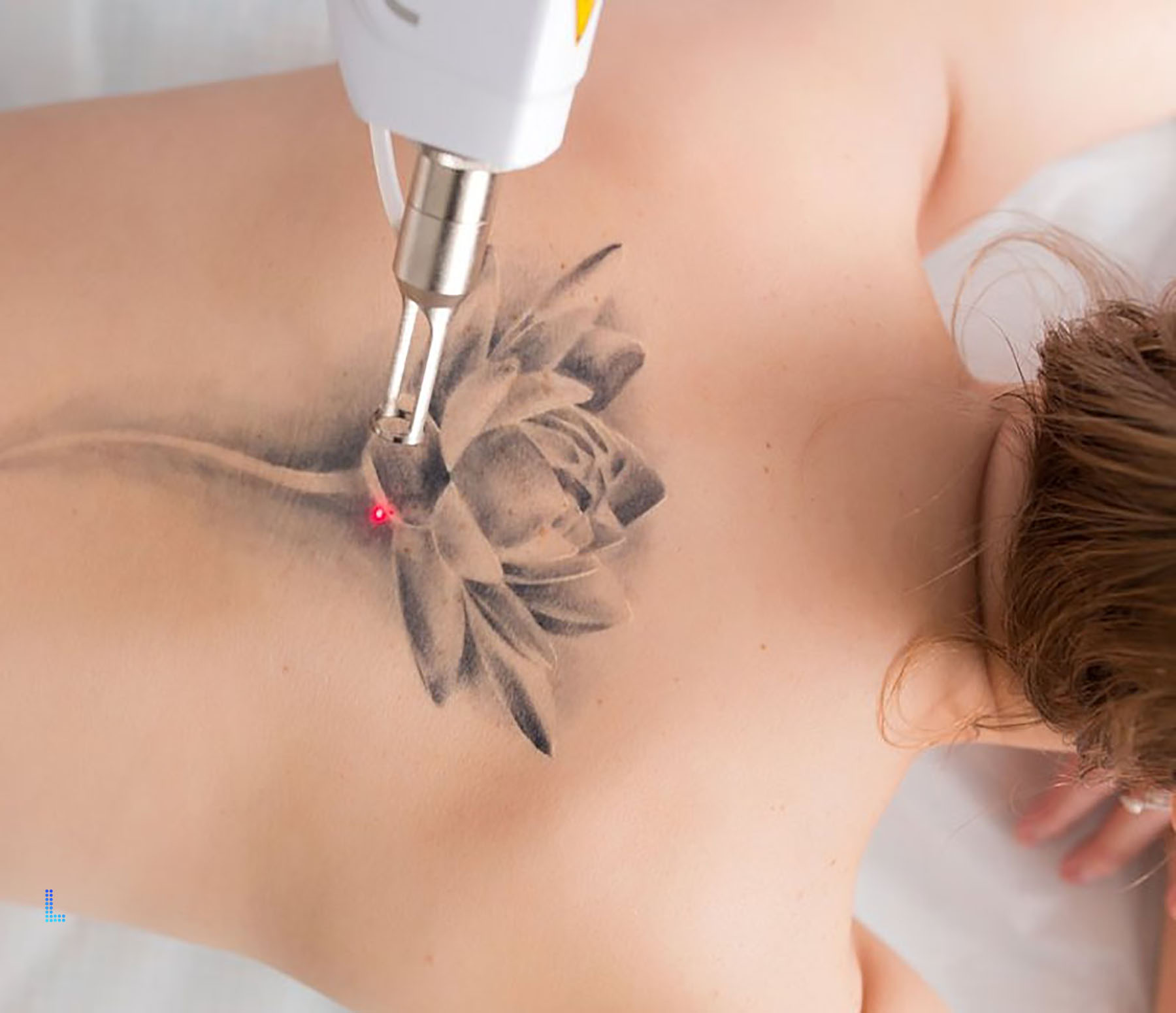 Skin Lasers Plastic Surgery in Lahore