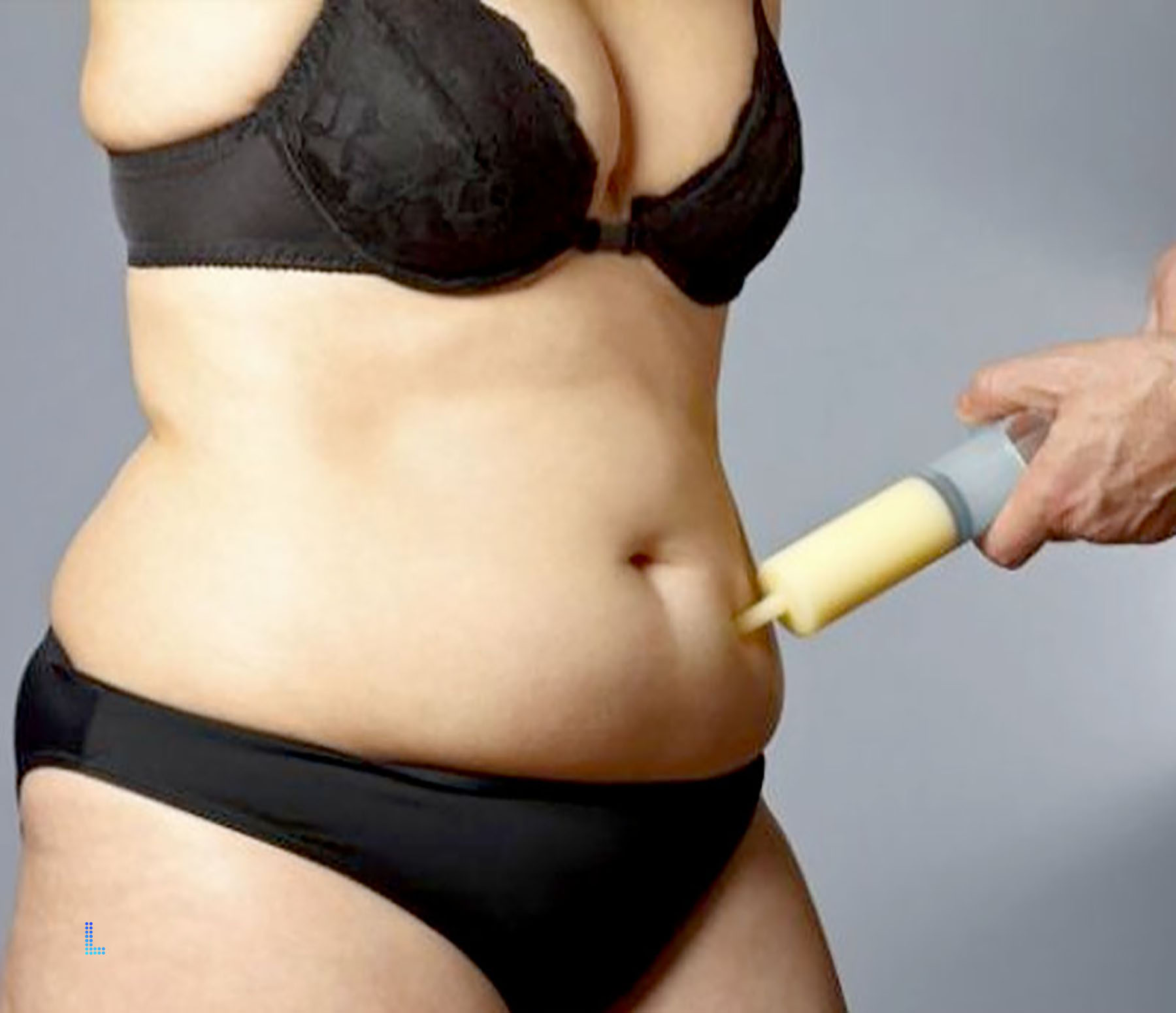 Follow Ups of Liposuction Plastic Surgery