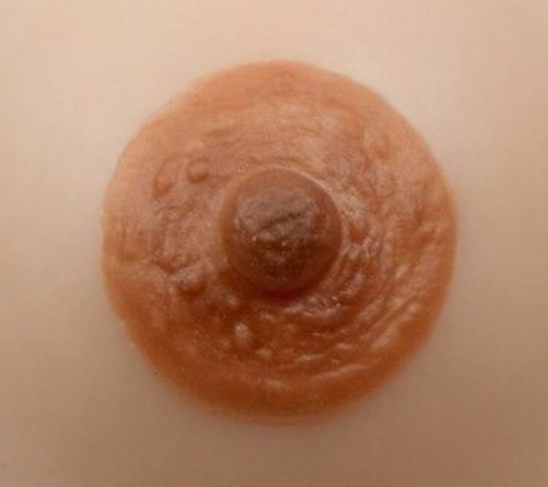 Ideal Patients for nipples Lahore