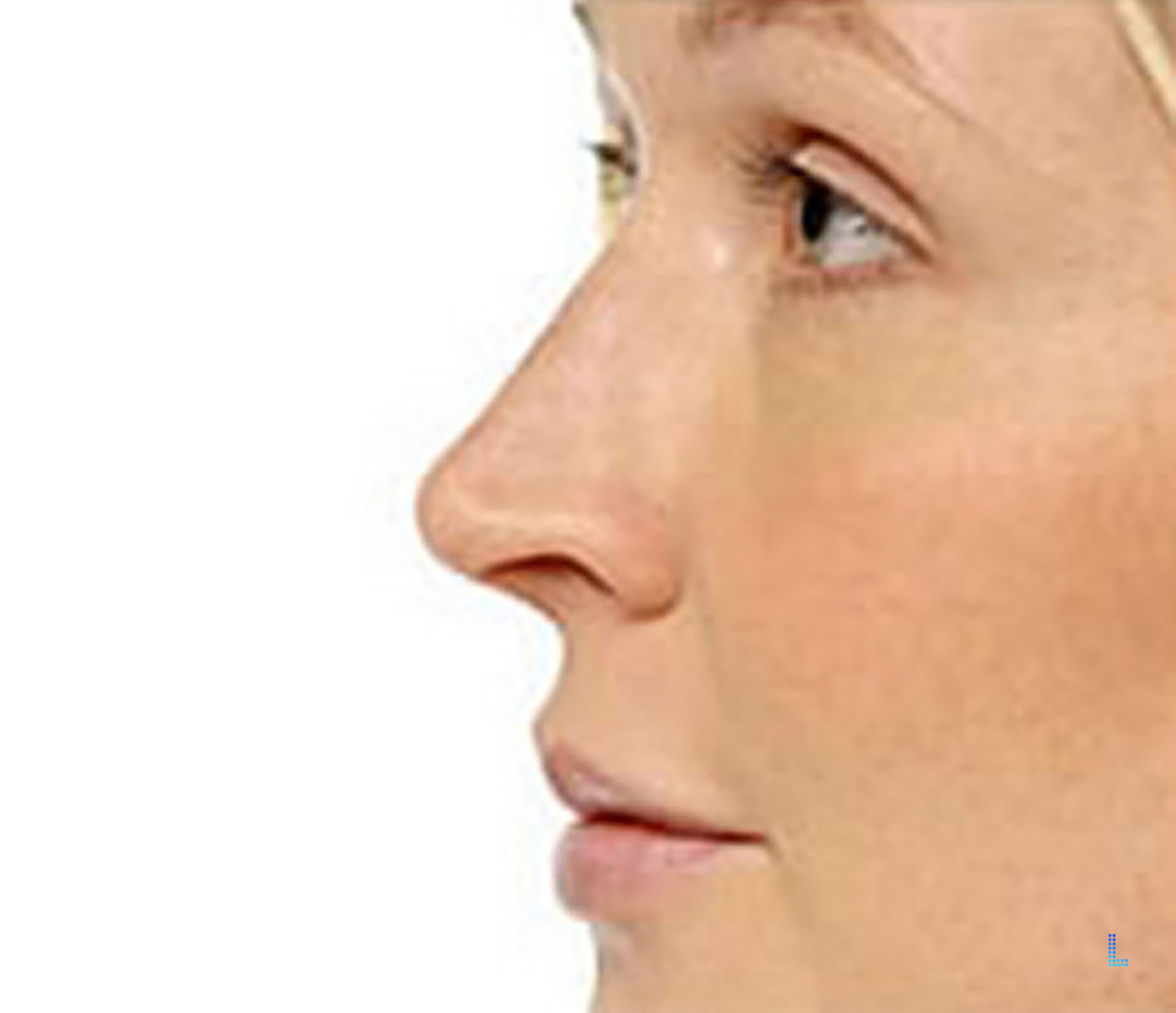 Follow Ups of Plastic Surgery