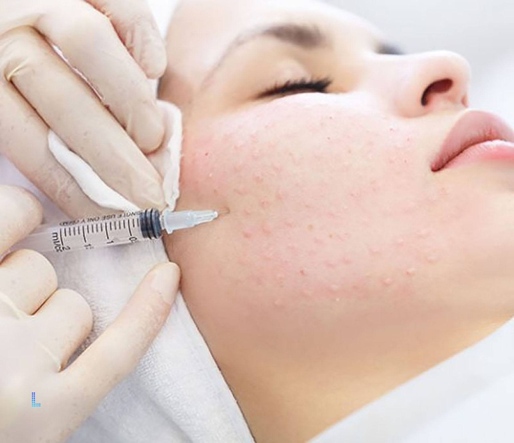 Best PRP Therapy in Lahore