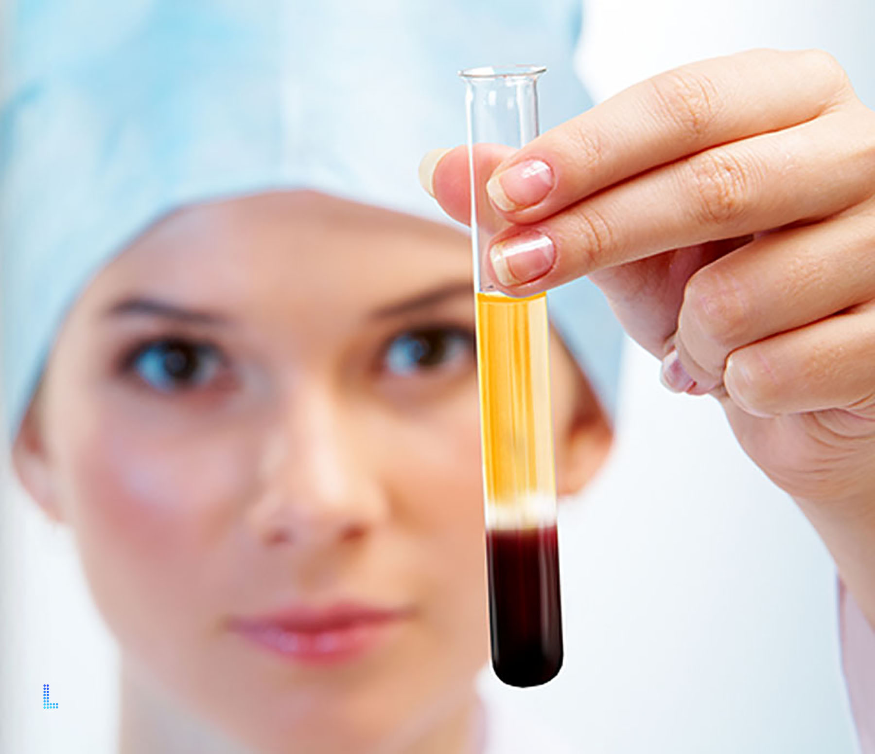 Best PRP Therapy for Hair in Lahore