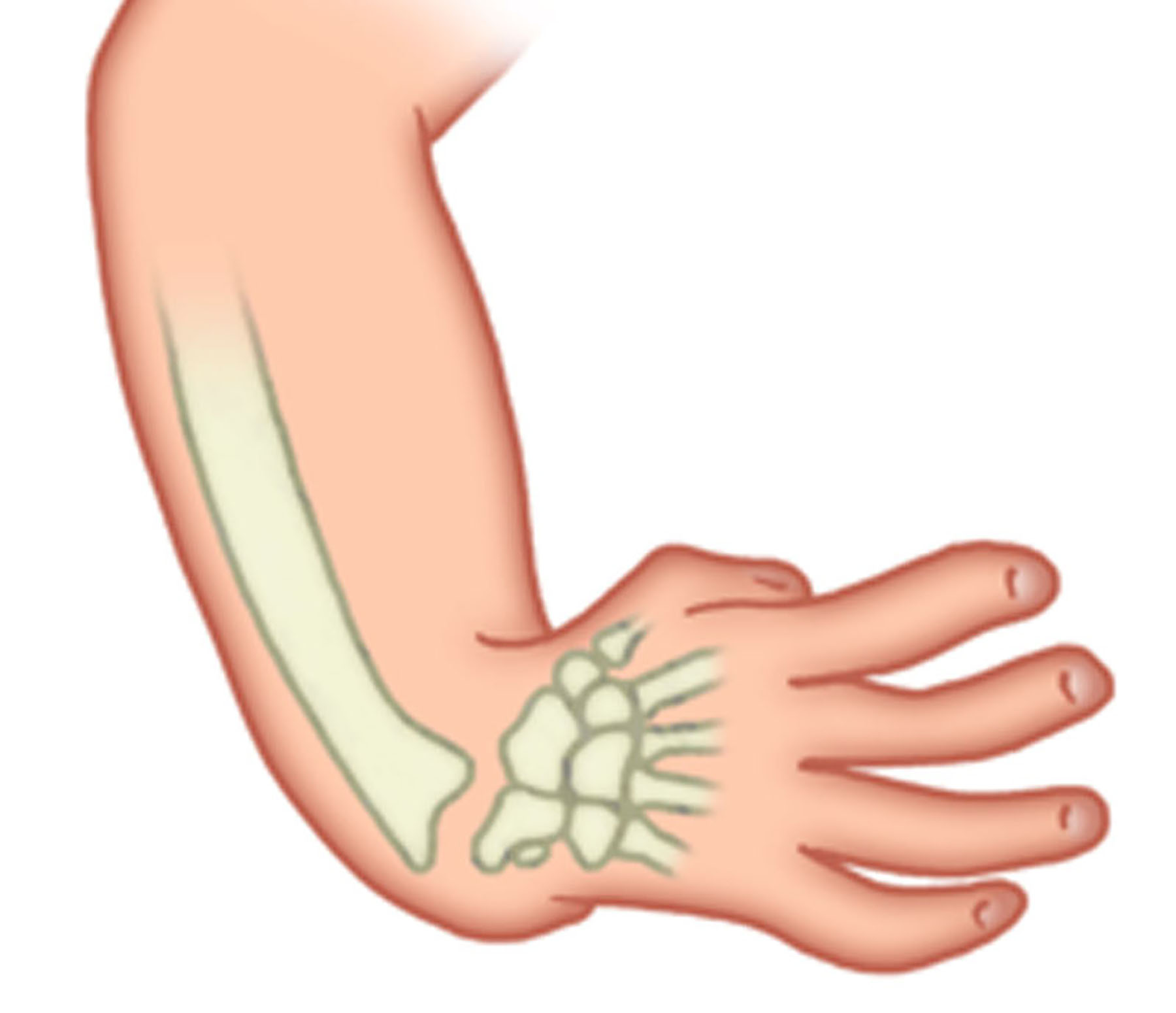 Short Hand best Plastic Surgery in Lahore