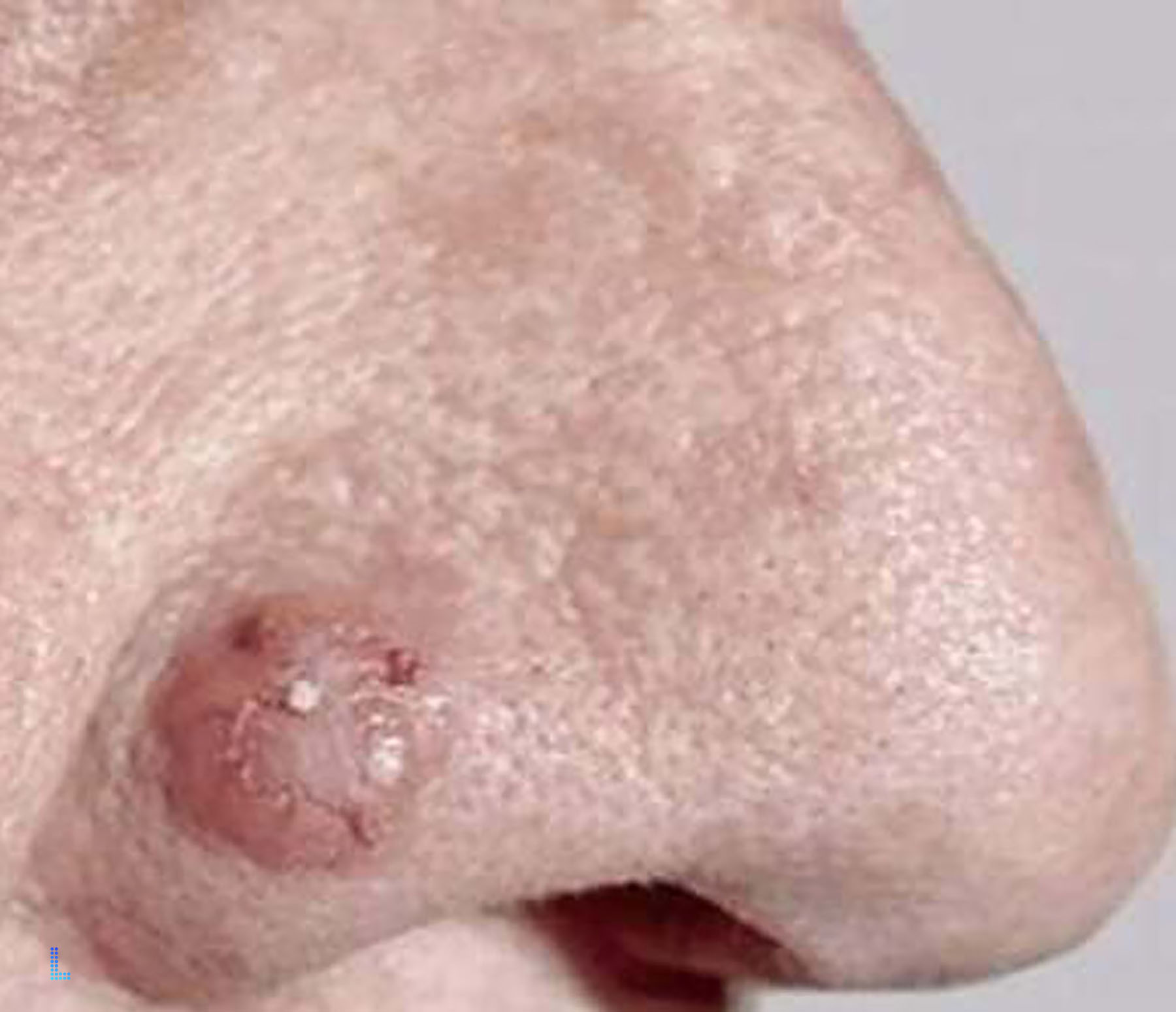Patient Satisfaction with Plastic Surgery in Lahore