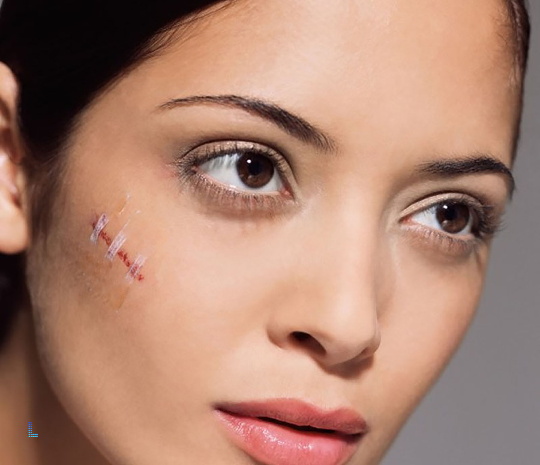 Follow Ups of Plastic Surgery