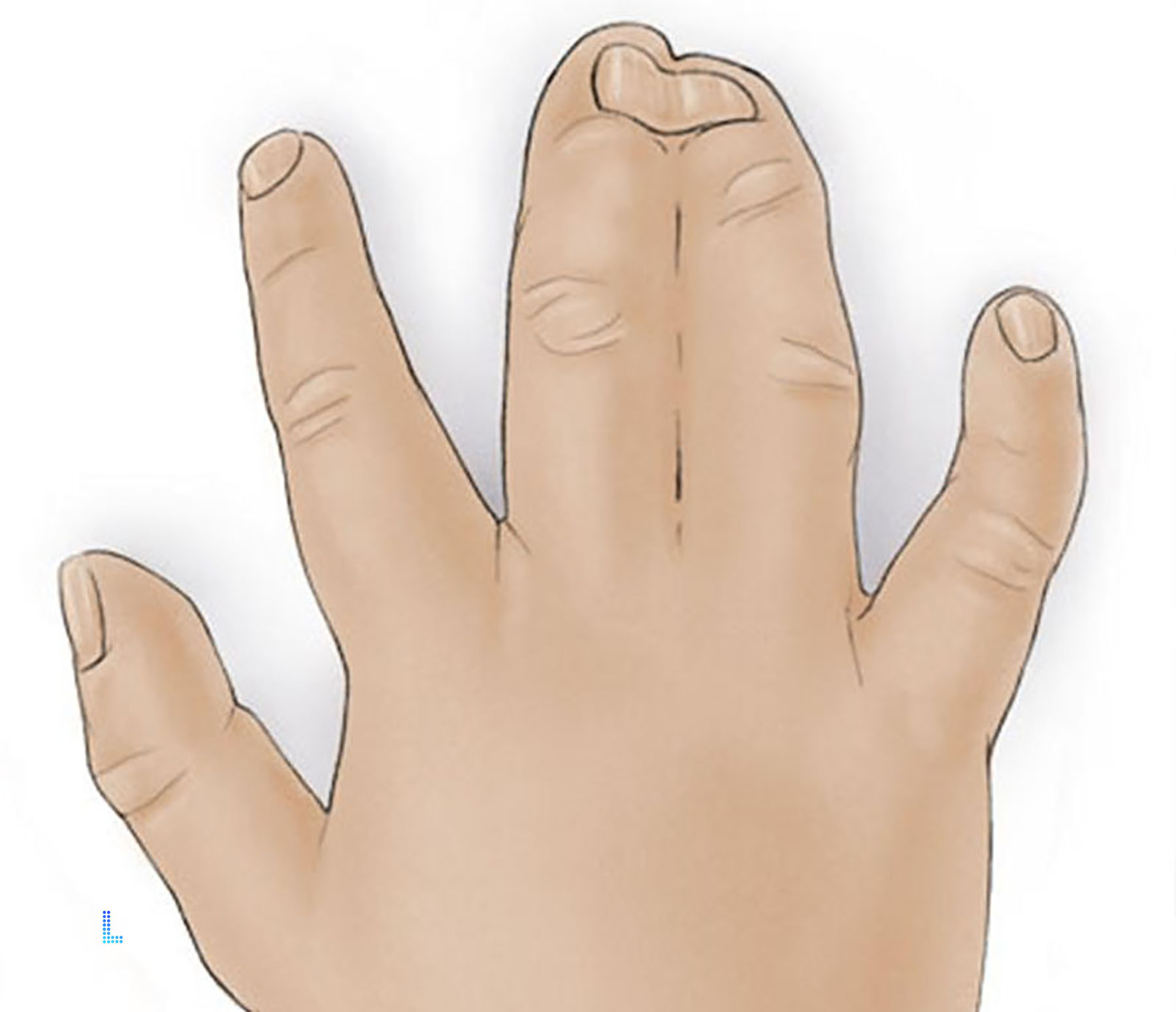 Common finger defects best in Lahore