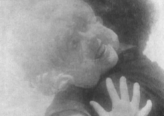Eraserhead