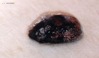 thumbnail image of subject