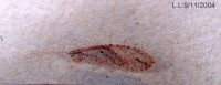 thumbnail image of subject