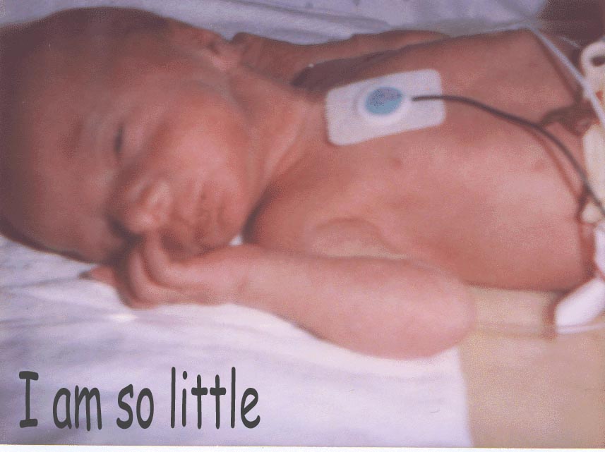 My First Day in the NICU