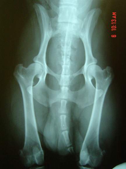 Bijou huip x-rays