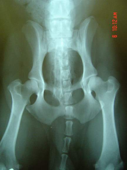 Harpad hip x-rays