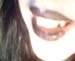 MoriahTeeth2