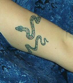 My left arm