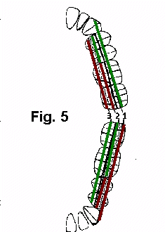 Cortes, vista oclusal