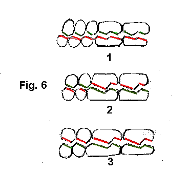 Cortes, vista lateral