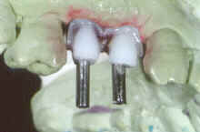 diapo24.jpg (3511 bytes)