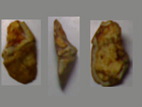 NOT a Neolithic scraper