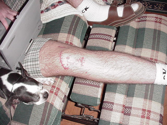 /user/knee1.jpg