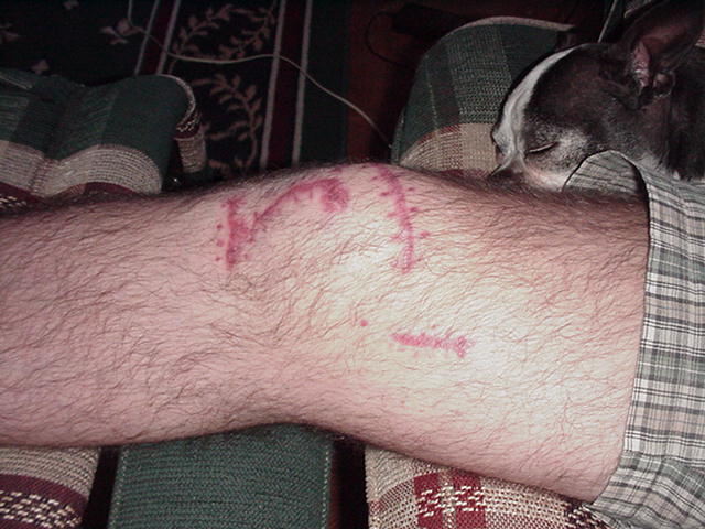 /user/knee3.jpg