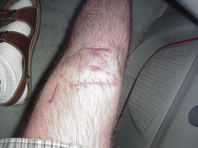 /user/knee4.jpg
