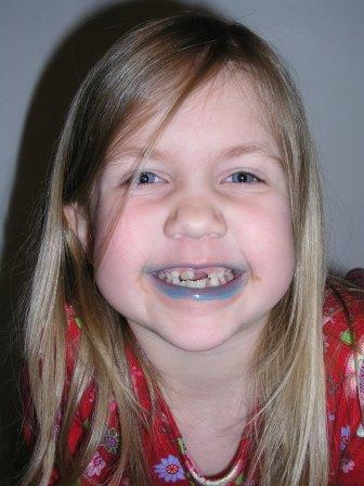 Bethan with blue lips