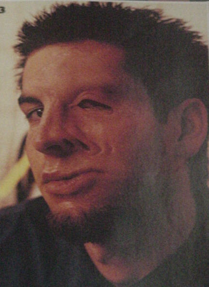 Rob Bourdon Loses Face