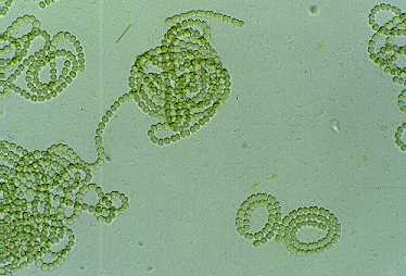 Bacteria