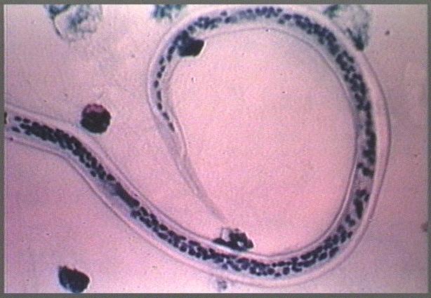Parasites