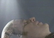 Brain surgery