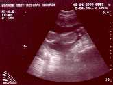 August 24, 2000