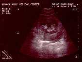 August 8, 2000