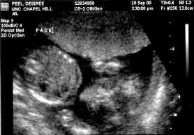 September 18, 2000