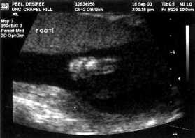 September 18, 2000