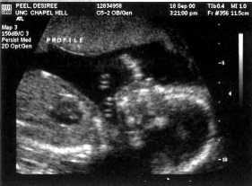 September 18, 2000