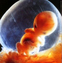 8 week old preborn