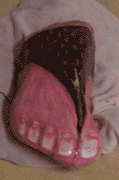 Sandal foot rock