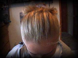 Hair