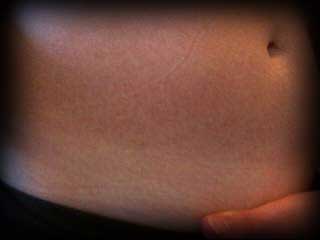 Tummy Tan